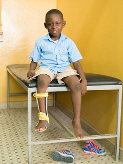 Geraldo Togo Orthesen