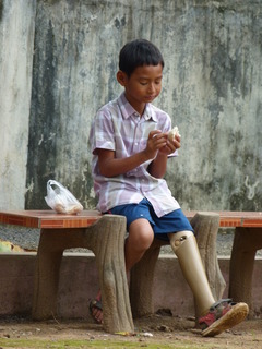 Kinder Prothesen